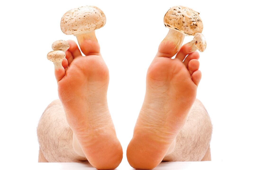 ciuperca kombucha a unghiilor de la picioare